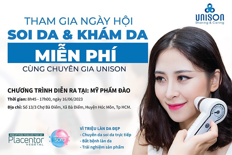 Soi da miễn phí cùng Unison